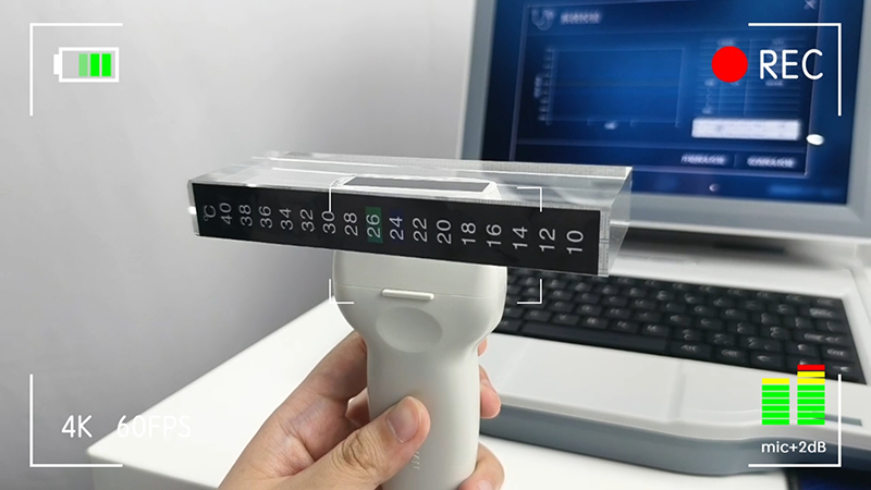 如何正確維護超聲骨密度儀？骨密度儀廠家建議的養護規范